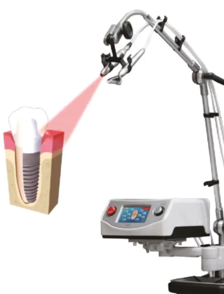articolo laser