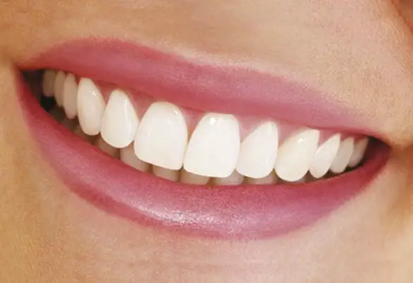 articolo-estetica-e-sorriso_1